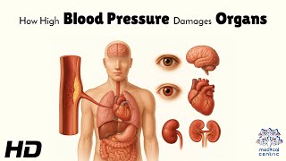 How High Blood Pressure Damages Organs