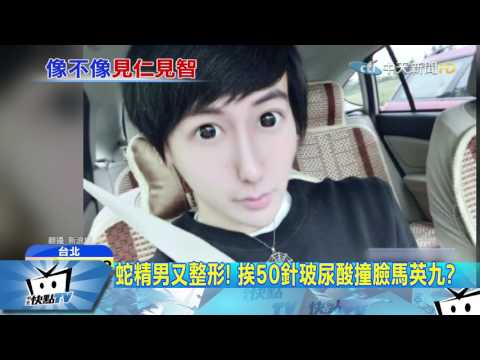 20170417中天新聞　蛇精男又整形！　挨50針玻尿酸撞臉馬英九？