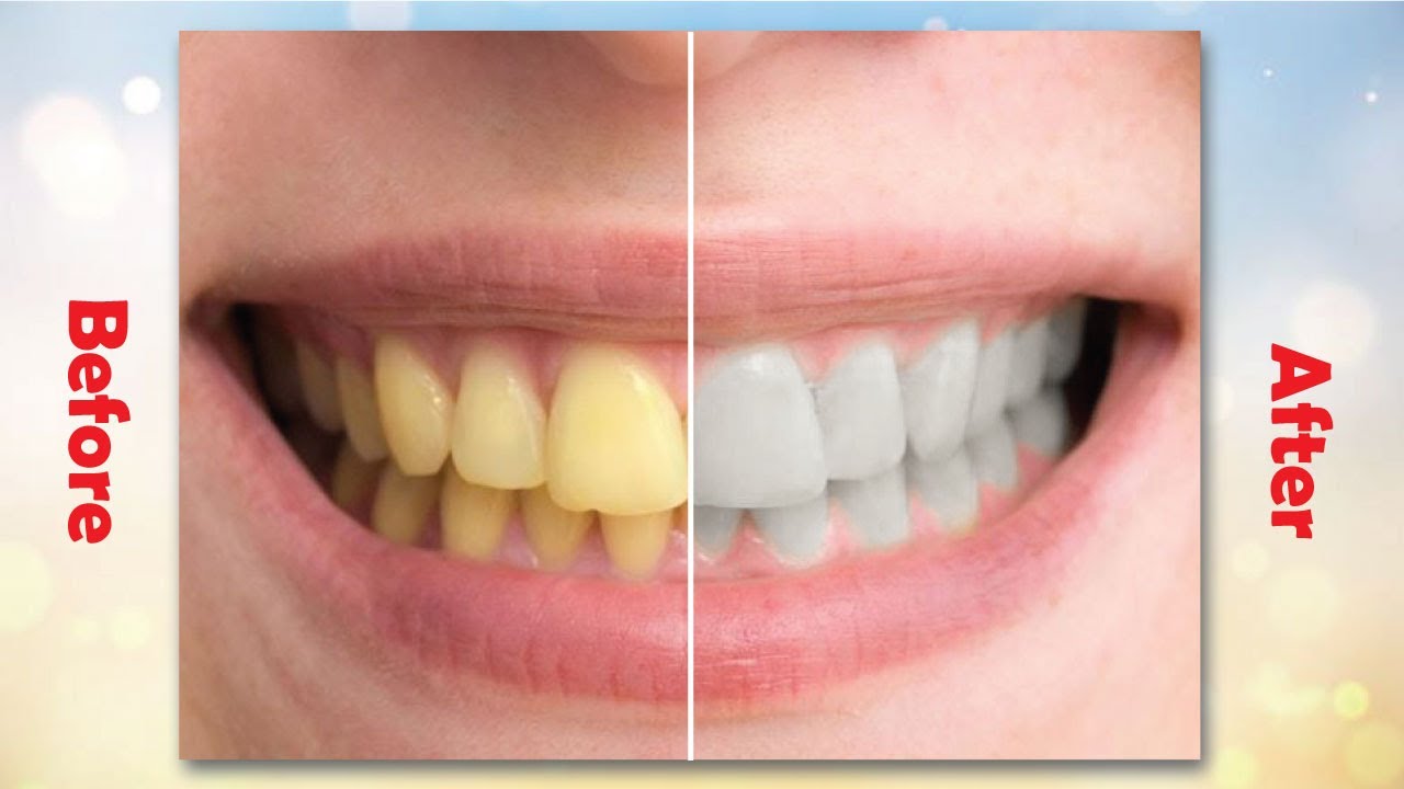 The Best Way To Whiten Teeth In Photoshop YouTube