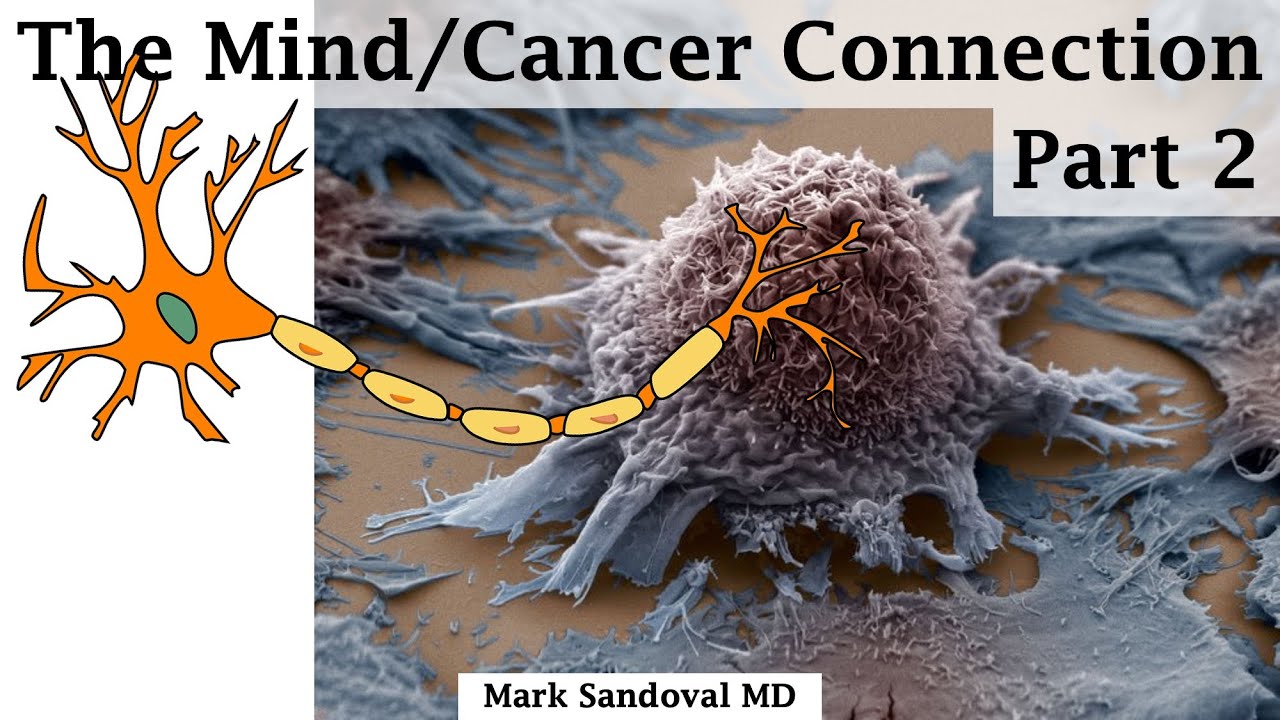 Cancer Connection The Mind-Cancer Connection - Part 2 - The Only Root Cure for Cancer ...