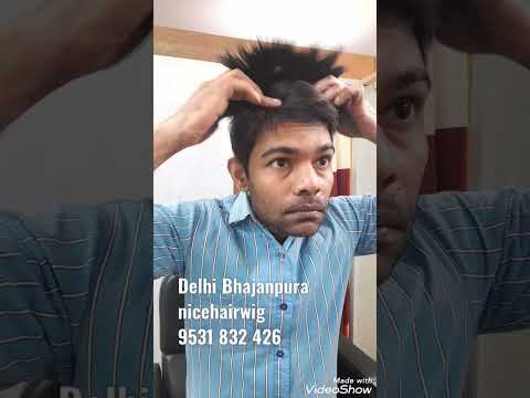 hair fixing Bhajanpura petrol pump Ke Samne nicehairwig 9531 832 426 #shorts