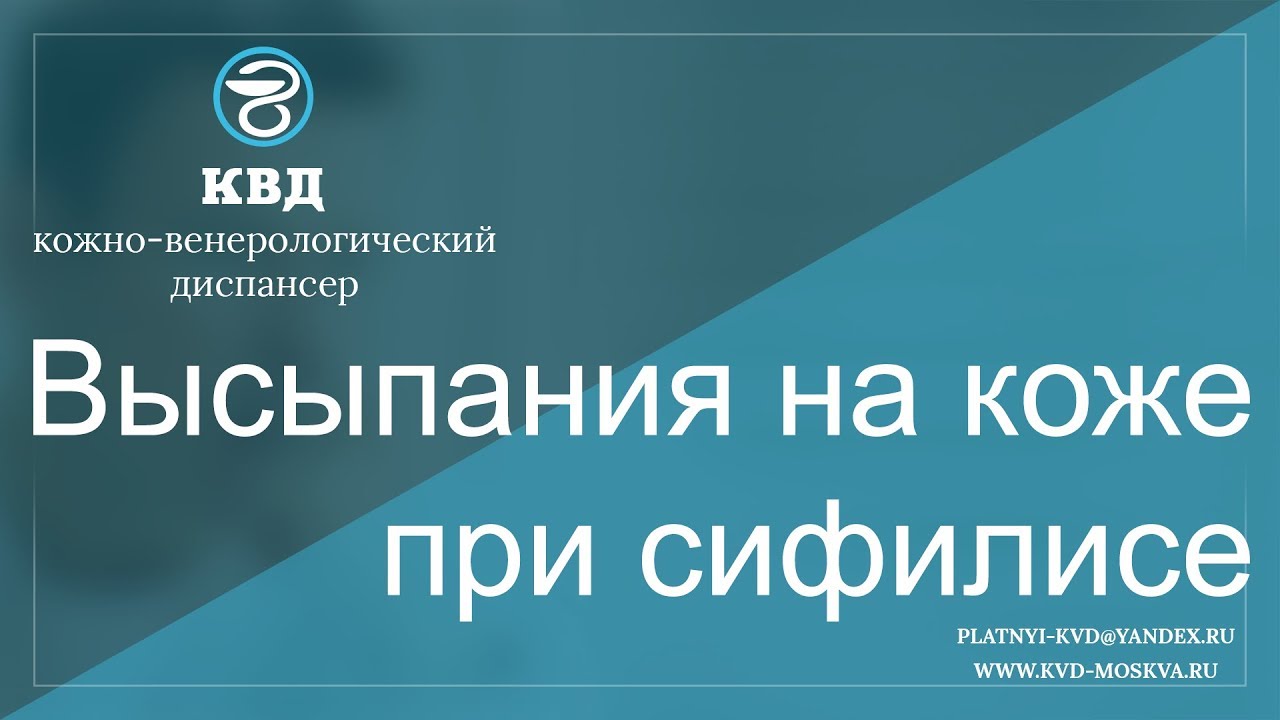677 Высыпания на коже при сифилисе - YouTube