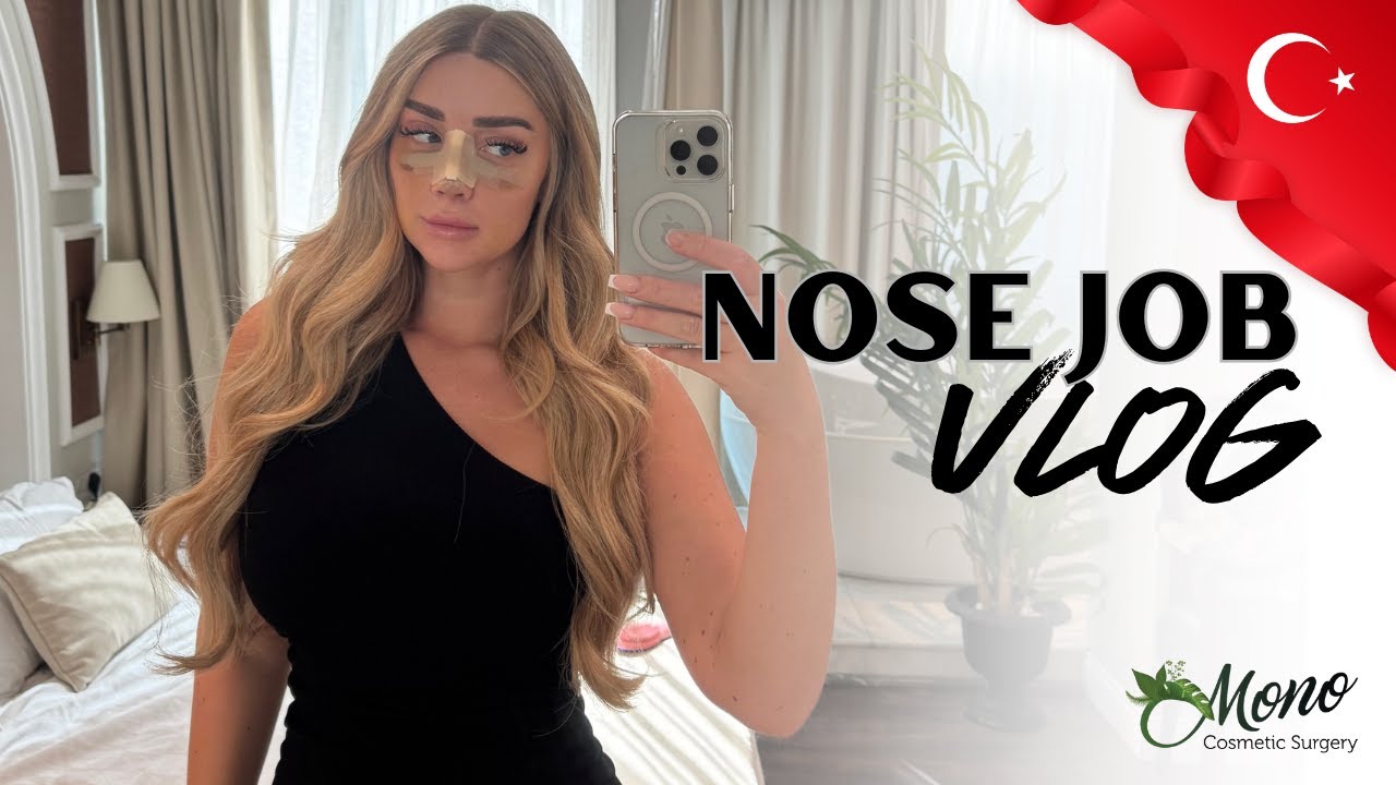 I flew to Turkey for a Nose Job... | Was it worth it?