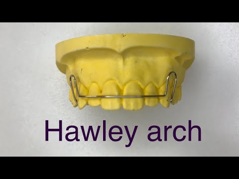 Wire bending series: Episode XIV Hawley arch