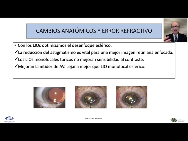 Escogiendo el Lente Intraocular Correcto para Pacientes con Glaucoma