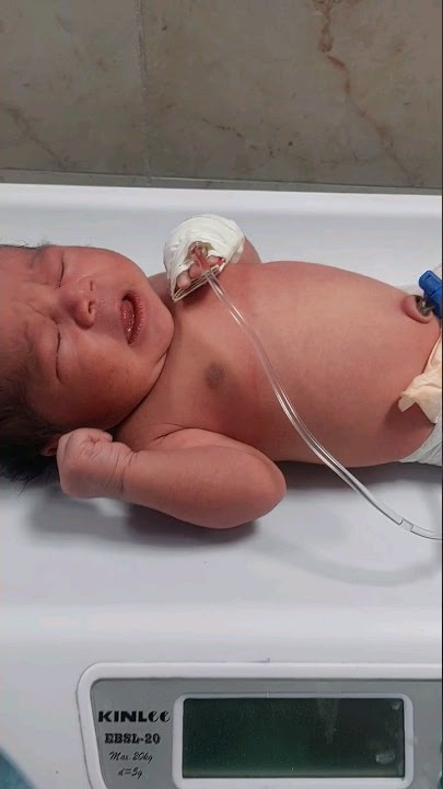 2.8kg boy In Nicu|amberry baby|#shortvideo #ytshorts