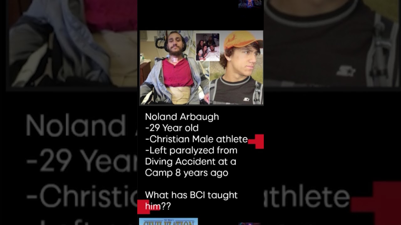 BREAKING - FIRST RELEASE OF NEURALINK PROCEDURE RESULTS