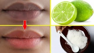 Make your lips black and beautiful in 5 minutes  Get natural pink lips at home (100% working) screenshot 2