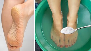 Get Rid of CRACKED HEELS Permanently - Magical Home Remedy screenshot 5