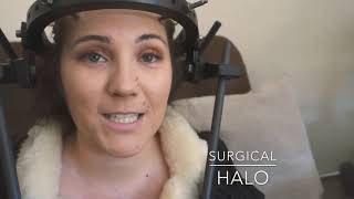 How I broke my neck + Surgical halo