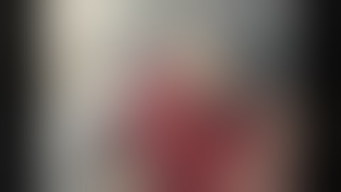 Percutaneous Fixation of Proximal Humeral Fractures