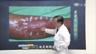 【志為人醫守護愛】20150708 - 特別節目 - 愛膚傷迎陽光(3)