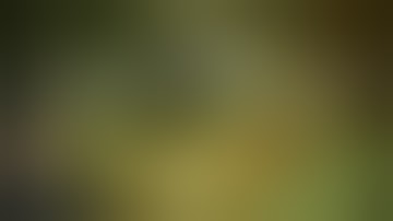 Case 6, Phacoemulsification Tips & Tricks .PXF & Brunescent Cataract