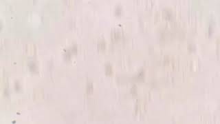 LEUCÓCITOS NA URINA. Como ocorre a presença de leucócitos no sedimento urinário.