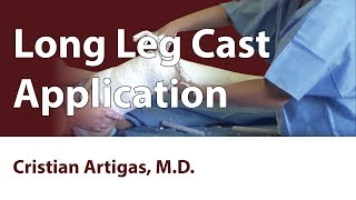Long Leg Cast Application