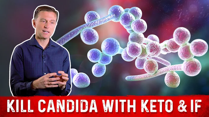 Kill Candida with Keto & Intermittent Fasting – Dr. Berg