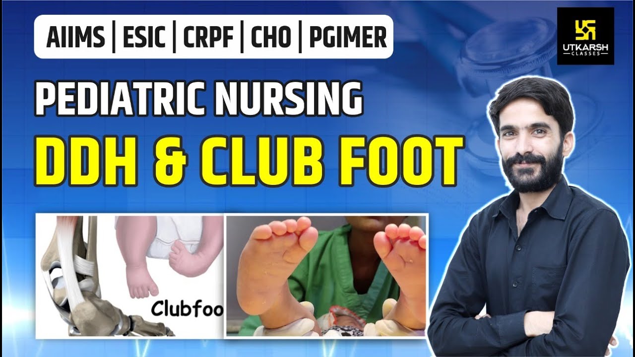 DDH and Club Foot | Pediatric Nursing | AIIMS | ESIC | CRPF | PGIMER | By Raju Sir