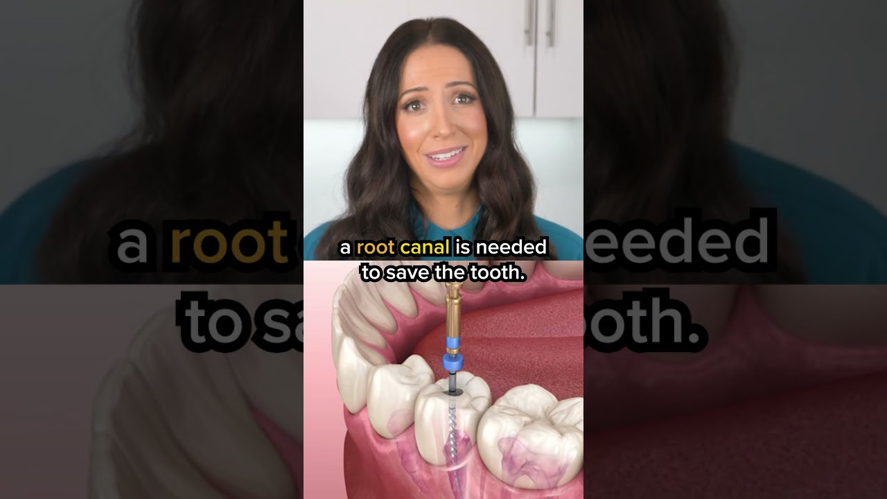 Cavities Can Turn Into Root Canals Shorts