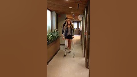 First Steps with her Prosthetic