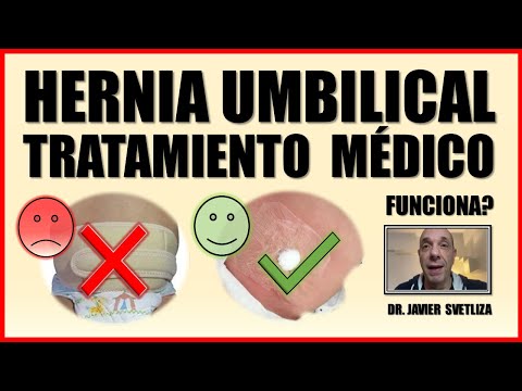 Vídeo: Hernia Umbilical En Recién Nacidos: Síntomas, Tratamiento, Masaje, Vendaje