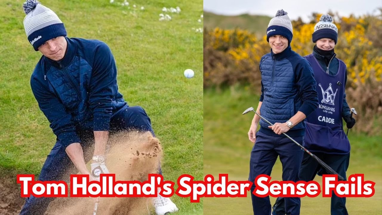 Tom Holland sports a bruise after 'being hit on the head with a golf
