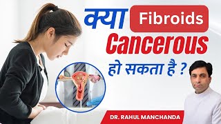 क य Fibroids Cancerous ह सकत ह Fibroids and Cancer Fibroids क sy