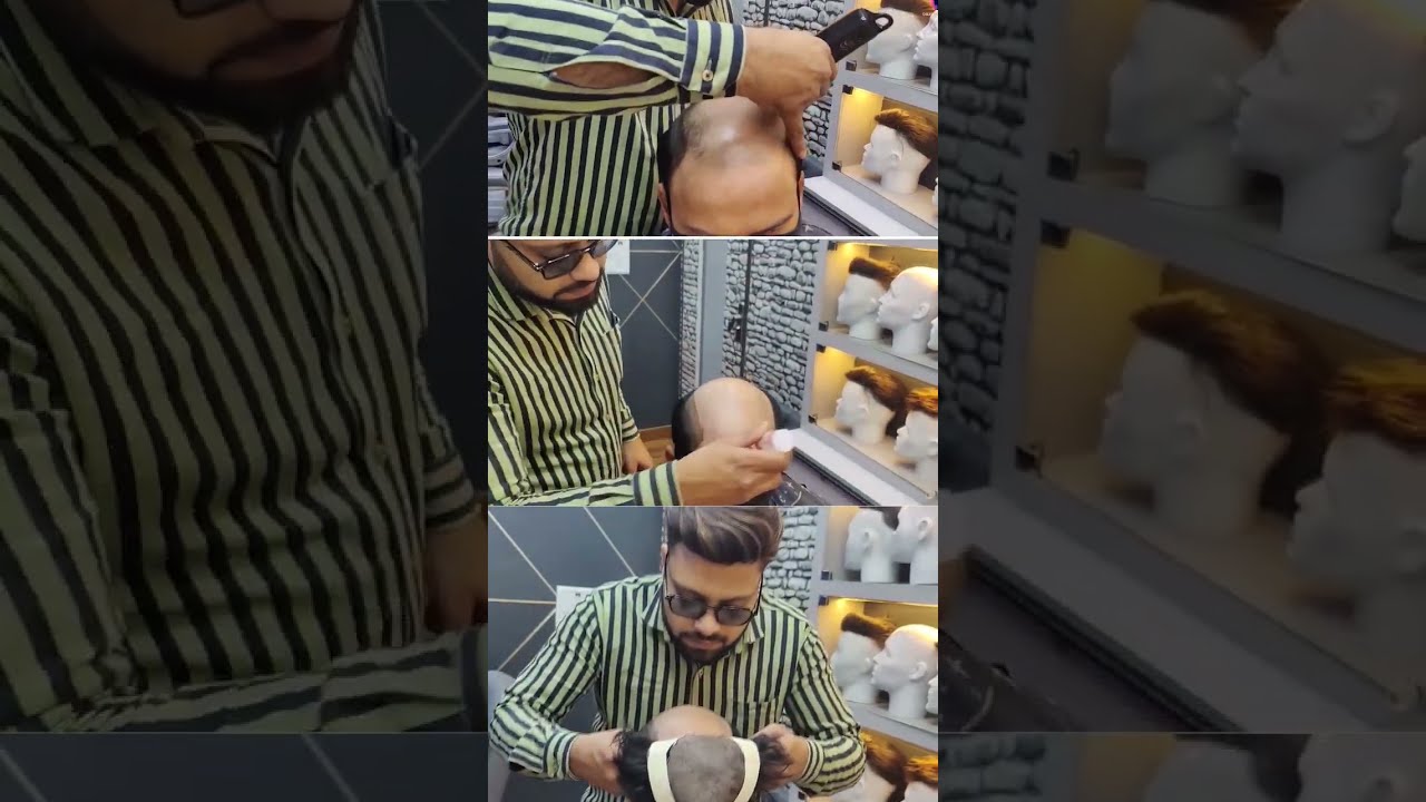 Frontline Australian Hair Patch 