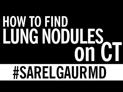 How to Find Lung Nodules on CT