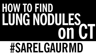 How to Find Lung Nodules on CT