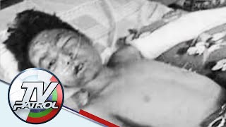 12 anyos nasunog ang katawan nang madamay sa C-130 crash | TV Patrol