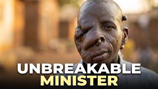 They Mocked Him as a Child… Years Later, He Became the “Minister of the Ugliest”
