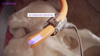 Medical Device Animation Reel | 3D Medical Device Visualization & HCP Training | Intervoke