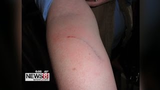 Dog Bites Several People, Including Young Girl And Teenager