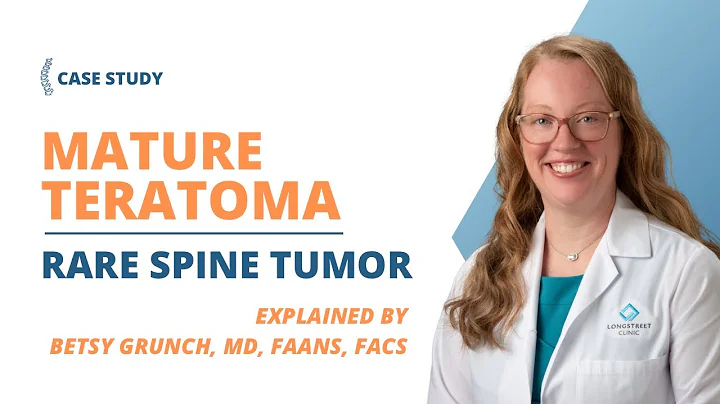 Case study 32 - Mature Teratoma in the SPINE??  rare spine tumor EXPLAINED by a neurosurgeon - DayDayNews