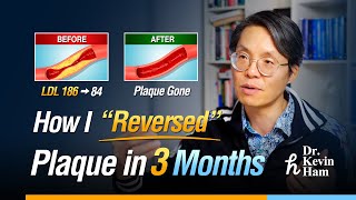 Download Lagu How I \ MP3