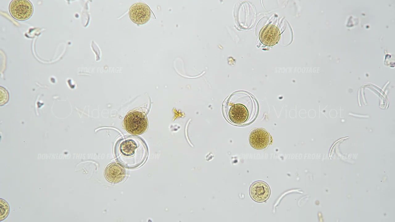 Spore of Equisetum arvense whole mount under miscroscope 100x on bright field