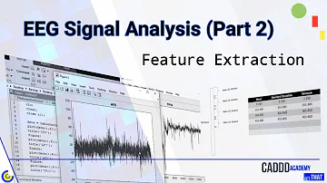 Comment activer le signal EEG ?