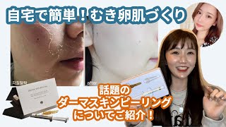 剥離ありのハーブピーリングの経過を徹底レビュー！効果やおすすめの
