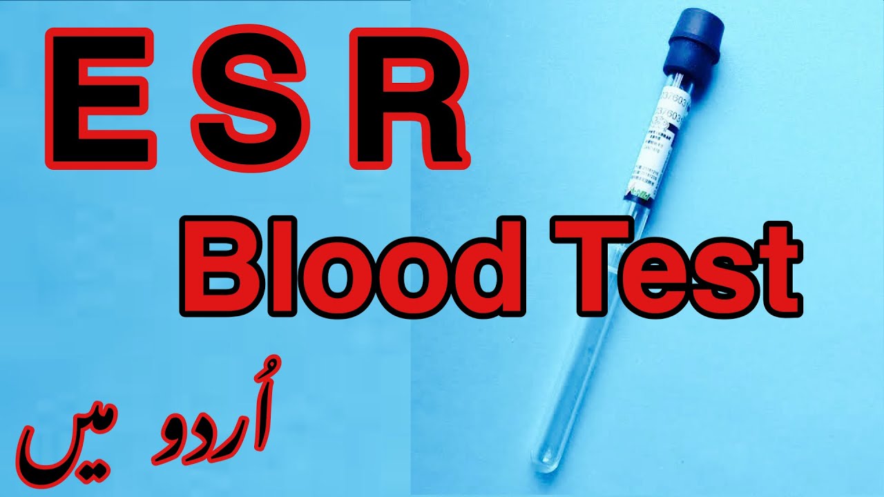 ESR Blood Test In Urdu Erythrocyte Sedimentation Rate ESR Why ESR 