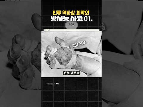 인류 역사상 최악의 <strong>방사능</strong> <strong>피폭</strong> 사고!