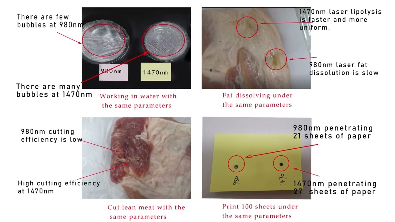 980nm vs 1470nm Diode Laser | What’s the Difference? Applications & Advantages Explained