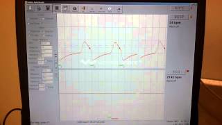 Dynamic Lung Phantom for Improved Calibration of Gaited PET Scans
