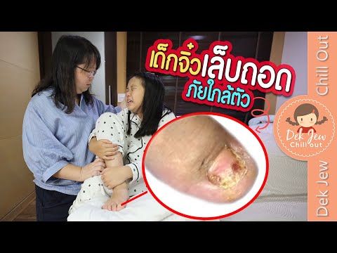 เด็กจิ๋วเล็บถอด ภัยใกล้ตัว | ละครเด็กจิ๋ว