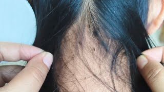 Asmr lice picking from my cousin's beautiful and long hair #asmrlicepicking #nitpicking #hairpulling