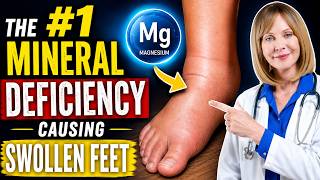 The #1 Mineral Deficiency Causing Swollen Feet