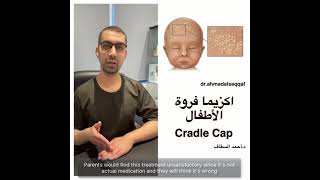دكتور أحمد السقاف Dr.Ahmad Alsaqqaf/  اكزيما فروة الأطفال Cradle Cap