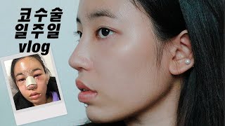 Download Lagu eng) 저..성형 했어요..👳‍♀️ | 코성형 일주일 vlog MP3