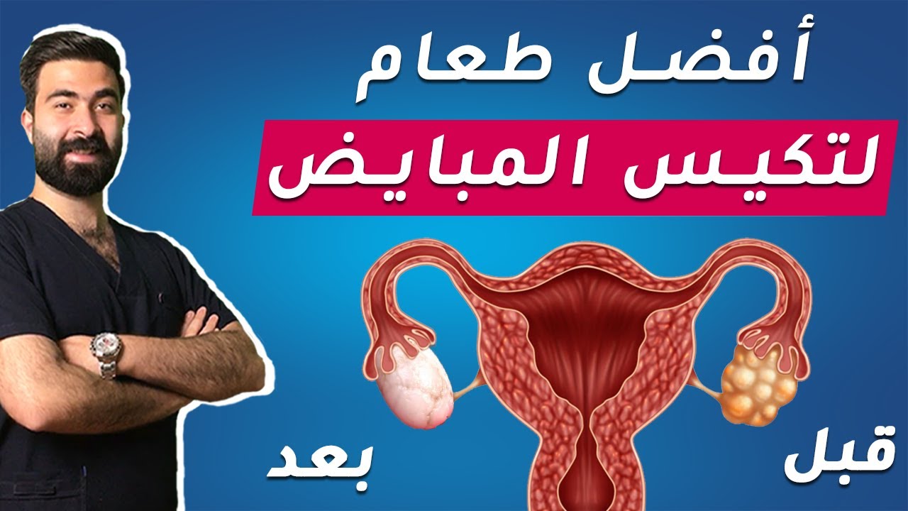 أفضل نظام غذائي لعلاج تكيس المبايض | علاج تكيس المبايض في 4 خطوات فقط | إحذري هذه الاطعمة !