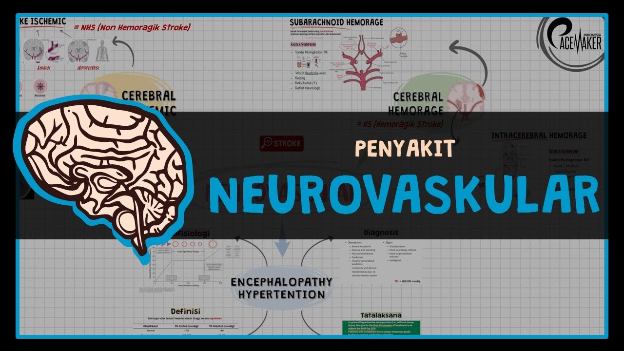 (STROKE) Cerebral Ischemic, Cerebral Hemorrhage & Encephalopathy Hipertension: NEUROVASCULAR DISEASE