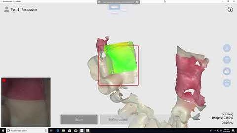 Dentron QuickScan IOS - Intraoral Scanner Demonstration
